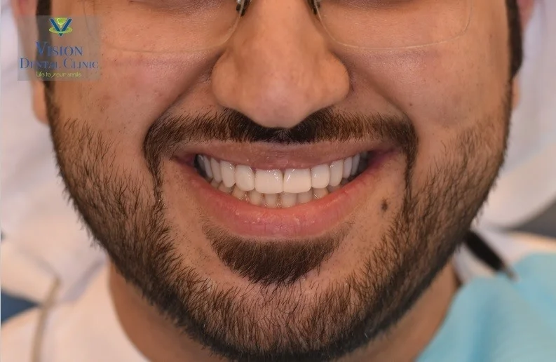 VISION DENTAL CLINIC L.L.C photo 7