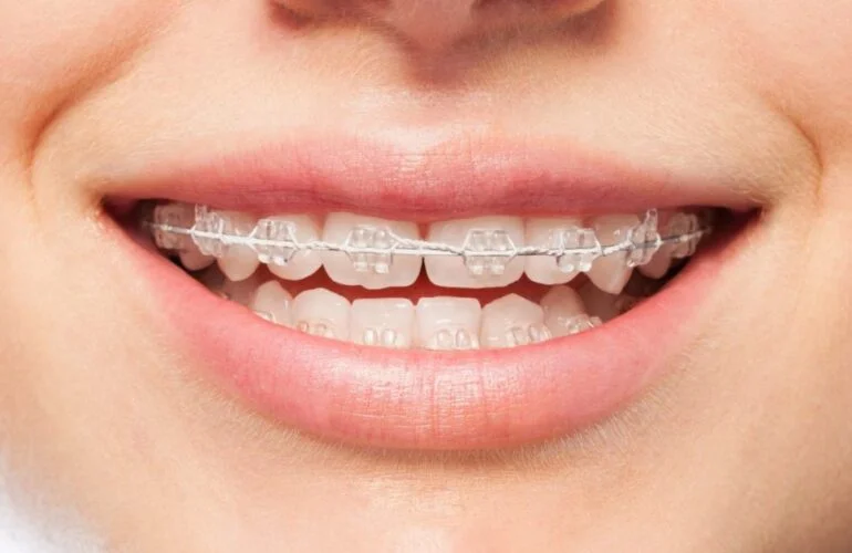 ASPEN DENTAL POLYCLINIC - L.L.C photo 4