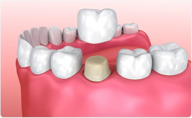 ASPEN DENTAL POLYCLINIC - L.L.C photo 5