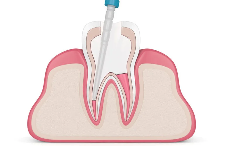 ASPEN DENTAL POLYCLINIC - L.L.C photo 6