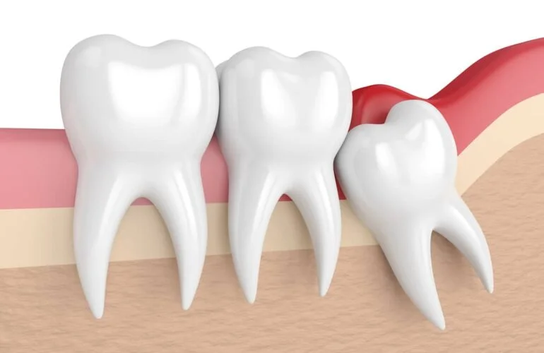 ASPEN DENTAL POLYCLINIC - L.L.C photo 7