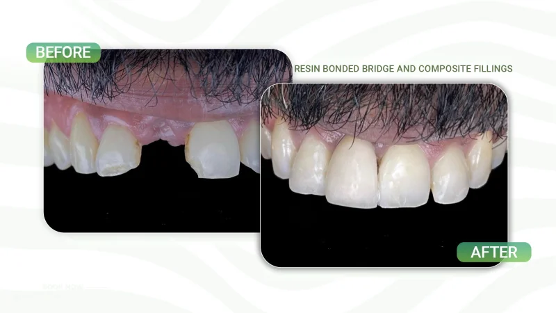 Smile Alreem Dental Center L.L.C. photo 3