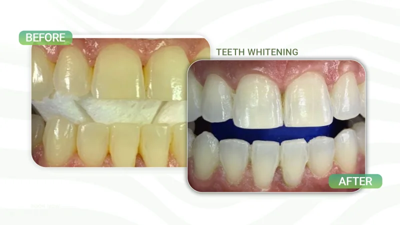 Smile Alreem Dental Center L.L.C. photo 4