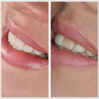 MARIGOLD DENTAL & ORTHODONTIC CLINIC L.L.C. photo 4