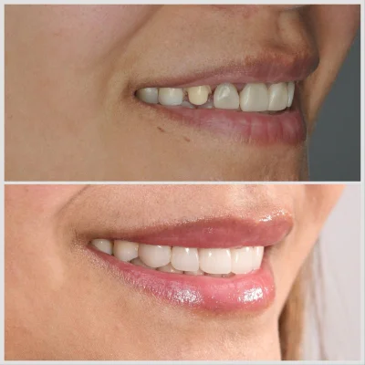 MARIGOLD DENTAL & ORTHODONTIC CLINIC L.L.C. photo 5