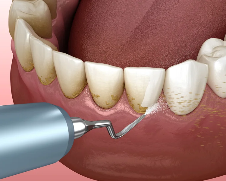 Bright Way Dental Clinic photo 2