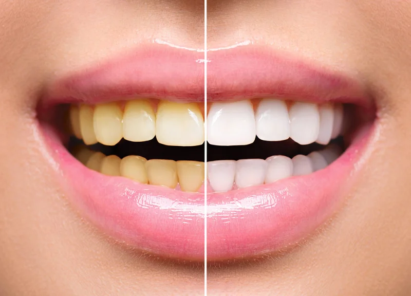 Bright Way Dental Clinic photo 3
