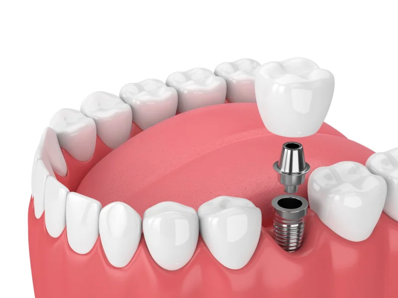 Bright Way Dental Clinic photo 7