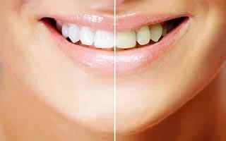 MORANI ORTHODONTIC CENTER & GENERAL MEDICAL - L.L.C photo 4