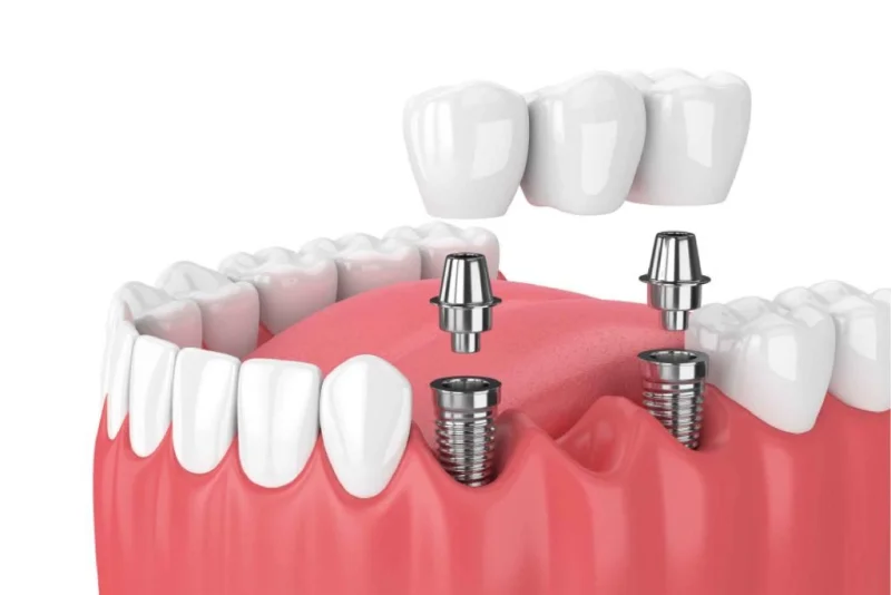 HOLLYWOOD SMILE MEDICAL CENTER - L.L.C photo 2