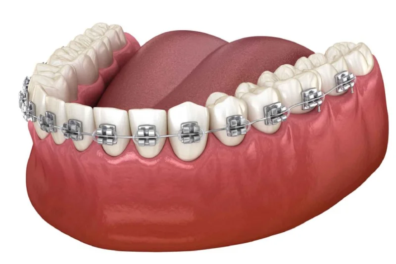 HOLLYWOOD SMILE MEDICAL CENTER - L.L.C photo 4