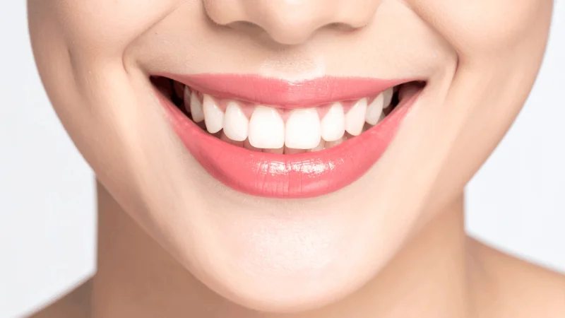 Italian Dental Clinic FZ-LLC photo 2