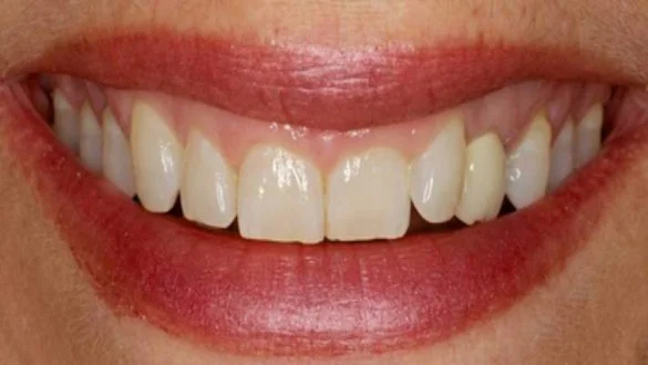 Al Dhafra Dental Center photo 5
