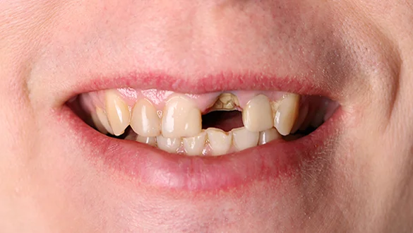 Al Dhafra Dental Center photo 6
