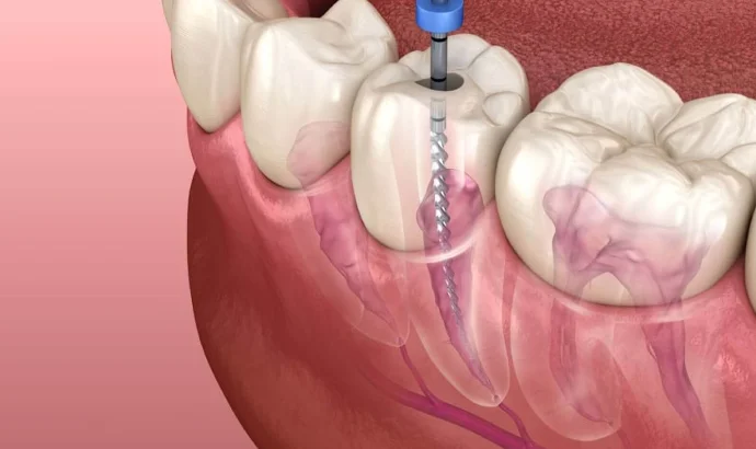 MODERN AL SALAM ORTHODONTIC & DENTAL CENTER photo 5