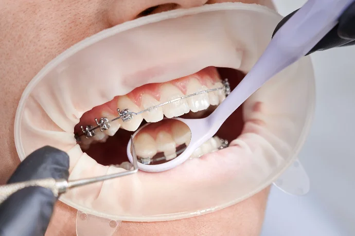 MODERN AL SALAM ORTHODONTIC & DENTAL CENTER photo 7