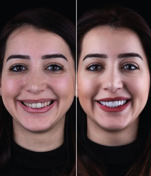 Dr Michaels Dental Clinic Branch photo 1