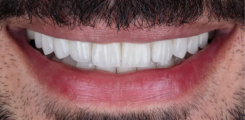Dr Michaels Dental Clinic Branch photo 2