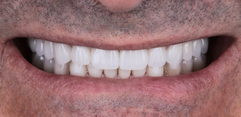 Dr Michaels Dental Clinic Branch photo 3