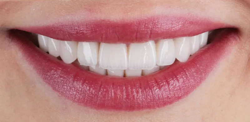 Dr Michaels Dental Clinic Branch photo 5