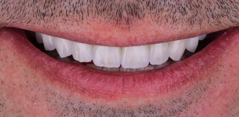 Dr Michaels Dental Clinic Branch photo 6