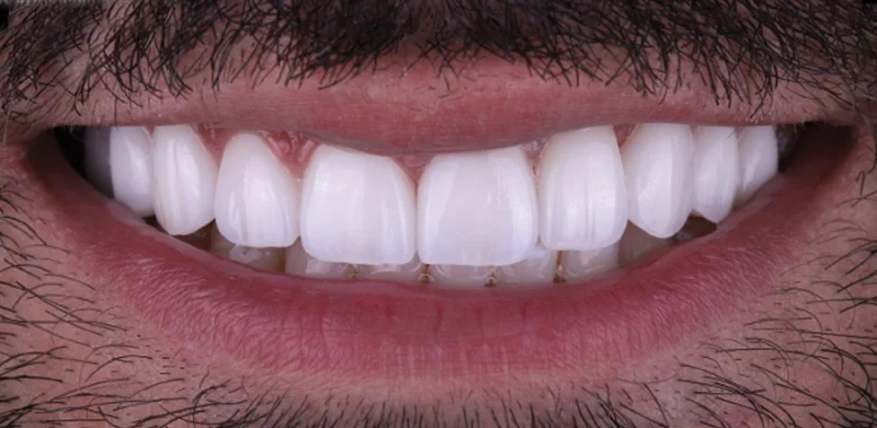 Dr Michaels Dental Clinic Branch photo 7
