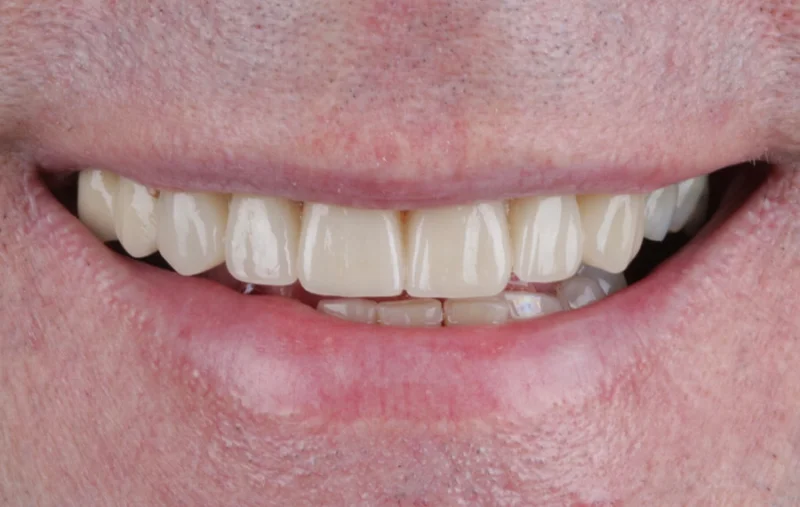Dr Michaels Dental Clinic Branch photo 8