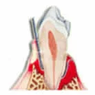 Dentzz Dental - Dmcc photo 6