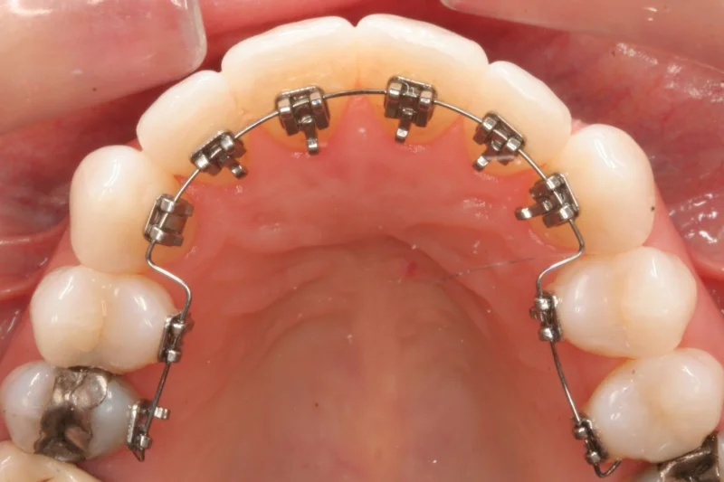 Munich Dental Clinic Branch photo 4