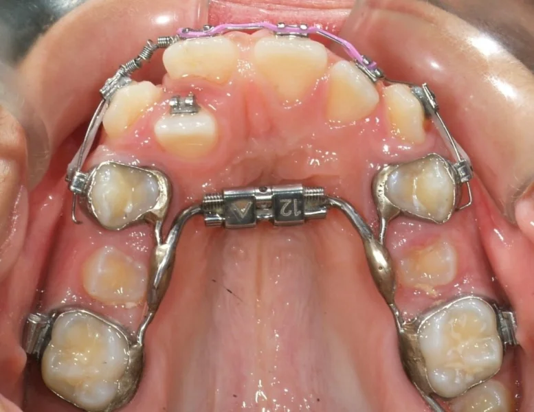 Munich Dental Clinic Branch photo 5