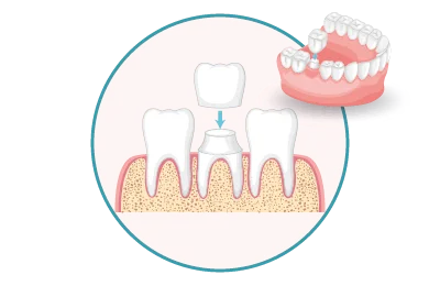 SMILEWORKS For Dental Surgery Clinic LLC photo 8