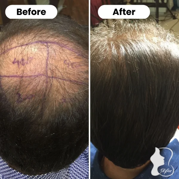 Dento Faces Cosmetic Clinic LLC photo 8