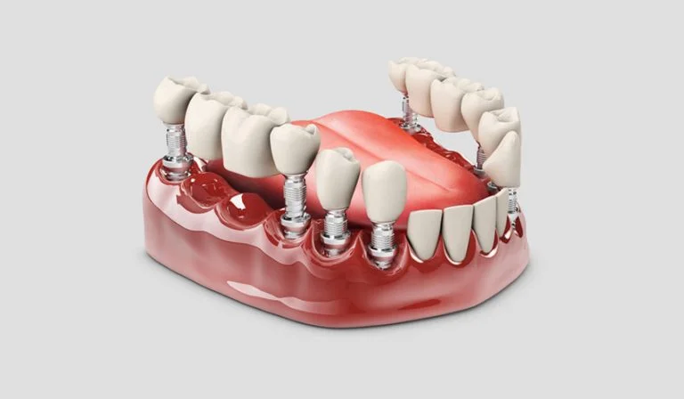 FACES AND BRACES DENTAL CLINIC L.L.C photo 4