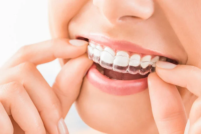 PRESIDENTS DENTAL AND AESTHETIC CLINICS L L C photo 7