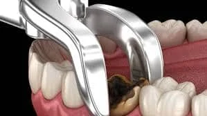 ALUER AESTHETIC & DENTAL CLINIC L.L.C photo 4