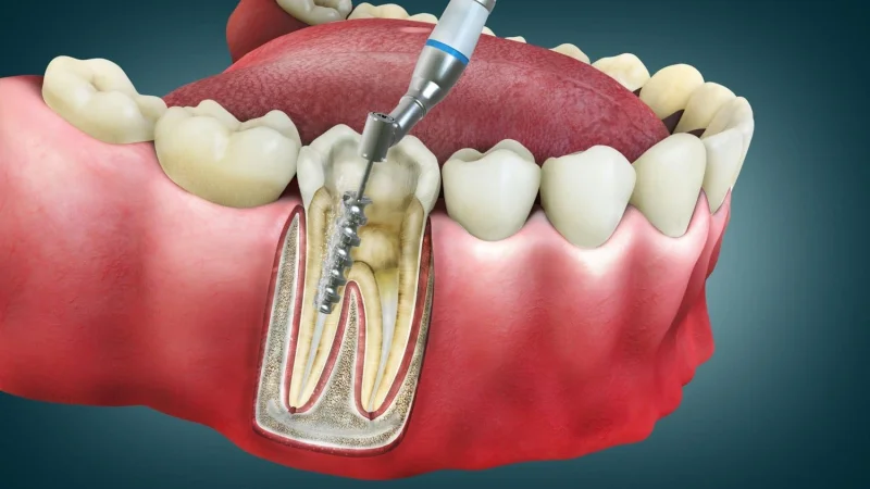 ALUER AESTHETIC & DENTAL CLINIC L.L.C photo 5