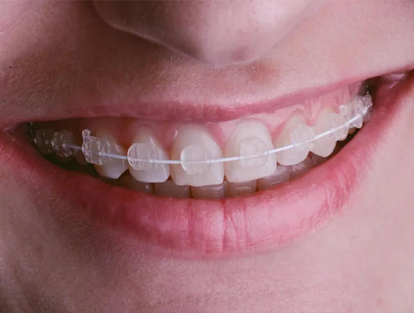 Dr Tosun Dental Clinic photo 5