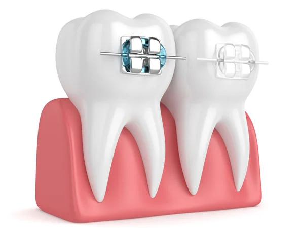 Dr Tosun Dental Clinic photo 7