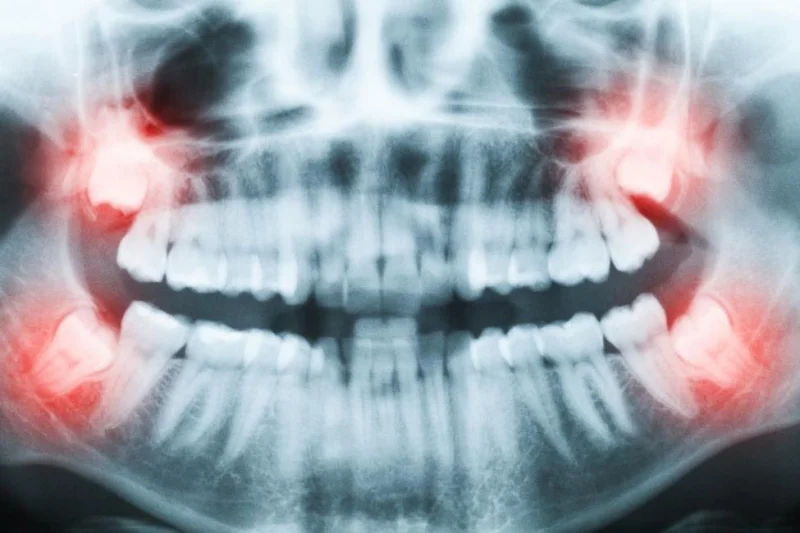 New Ivory Dental And Implant Clinic LLC photo 5
