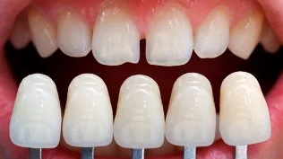 FACTOR SMILE CLINIC L.L.C photo 5