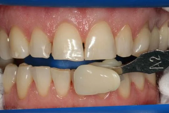 FACTOR SMILE CLINIC L.L.C photo 7