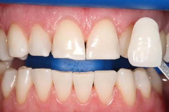 FACTOR SMILE CLINIC L.L.C photo 8