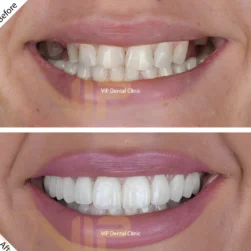 D C V I P Dental Clinic LLC photo 5