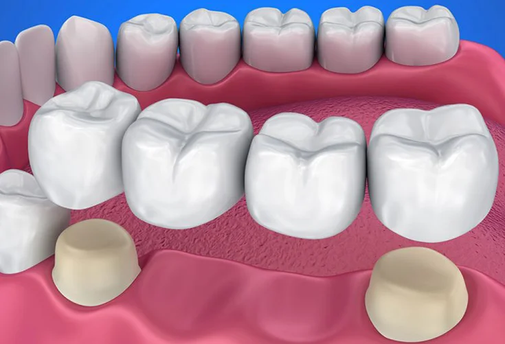 STARRY SMILE DENTAL CENTRE L.L.C photo 5