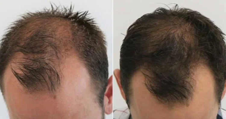 GENTLEMAX CLINICS LLC photo 6