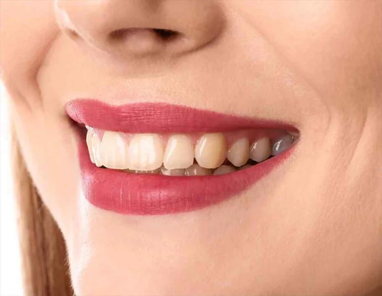 DR HALA ALSAKKA DENTAL CLINIC L.L.C photo 8