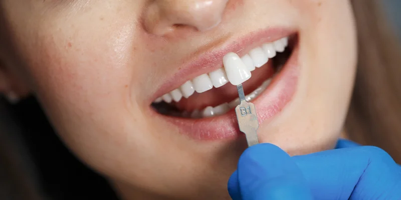 SAHARA DENTAL CLINIC AND ORTHODONTIC CENTRE L.L.C (BRANCH) photo 6
