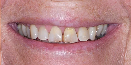Dr Joy Dental Clinic- Llc Branch-Ummsuquim photo 6