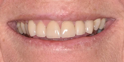 Dr Joy Dental Clinic- Llc Branch-Ummsuquim photo 7