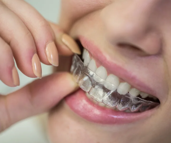 Nava Dental Care LLC photo 1